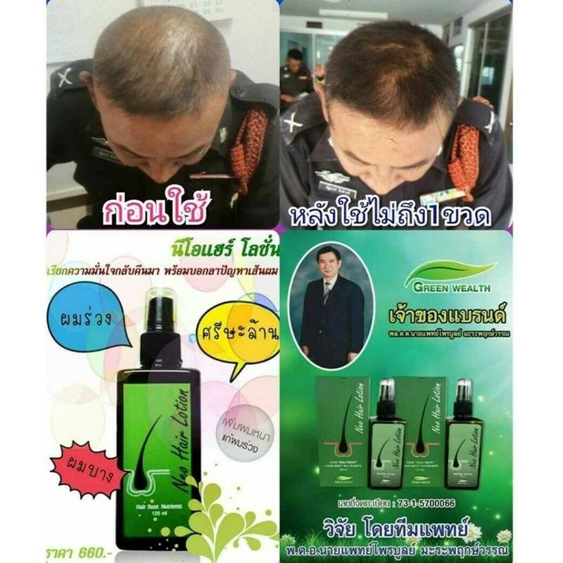 120ml nueva loción para el cabello para el pelo de raíz, barba y patillas más largas a base de hierbas 100% tratamiento Original nutrientes MSDS