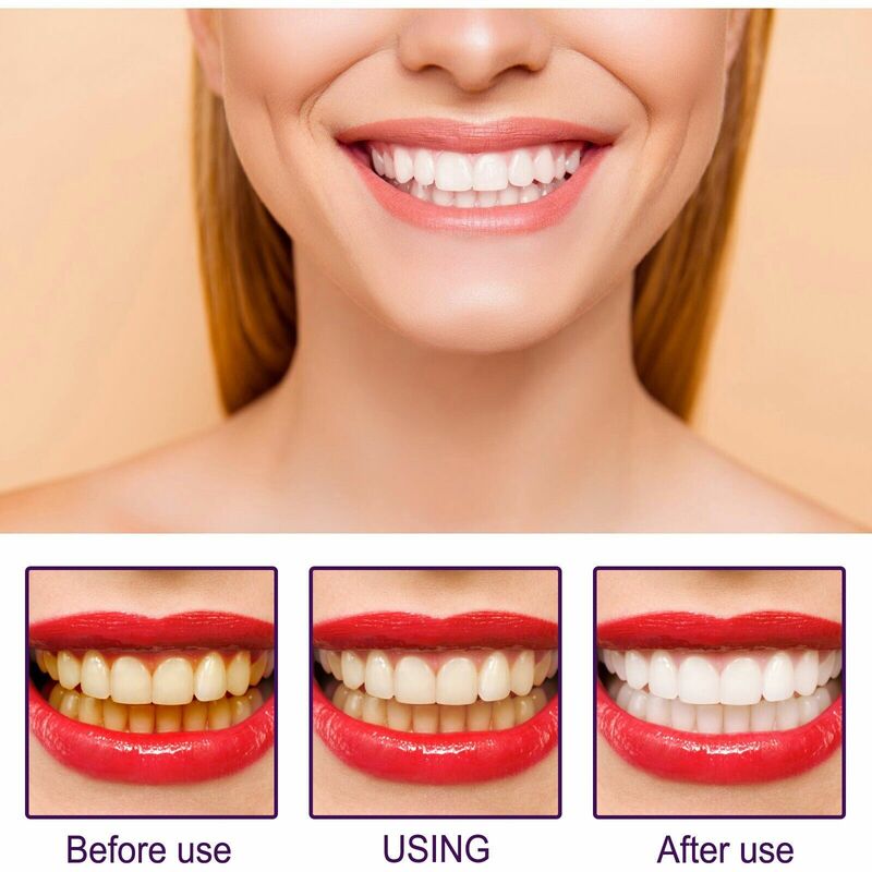 3ml pisak do wybielania zębów Serum czyszczące usuwa plamy z płytki nazębnej wybielające zęby żel do wybielania zębów higiena jamy ustnej narzędzie do stomatologii