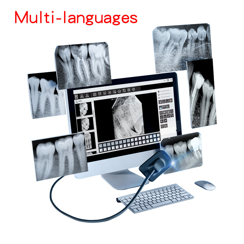 Dental Xray Sensor Digital Multi Language Size 1 Intra-Oral Include Software USB RVG X-ray Medical Equipment