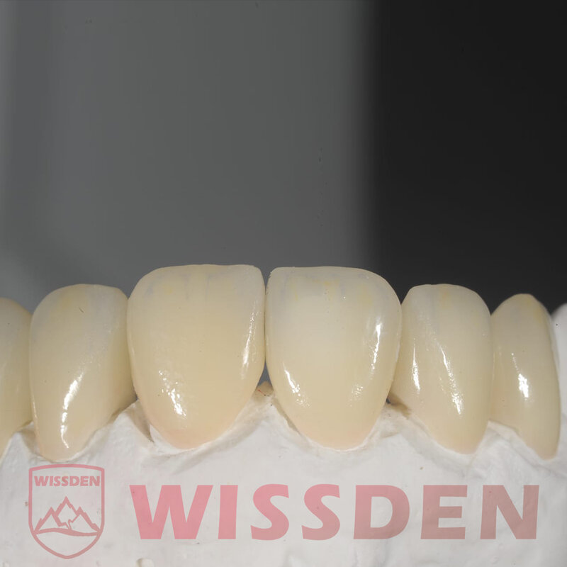 مكعبات أسنان سيراميك مع مكعبات ليثيوم ديسيليكات ، مكعبات أسنان سيراميك ، C14 Wissden ، CAD وcam ، أفضل تعليقات فورية للعملاء ، 5 ،