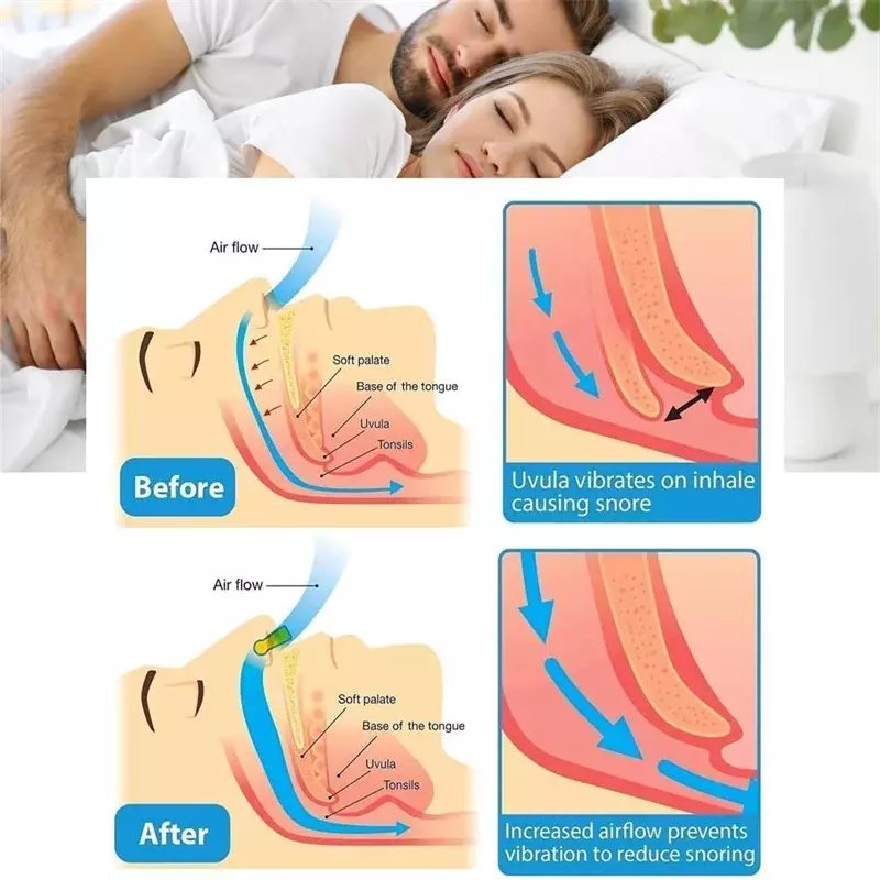 Corrector antirronquidos dispositivo de prevención de ronquidos dispositivo antirronquidos para mujer eliminación de ronquidos Clip nasal para hombres noche de sueño