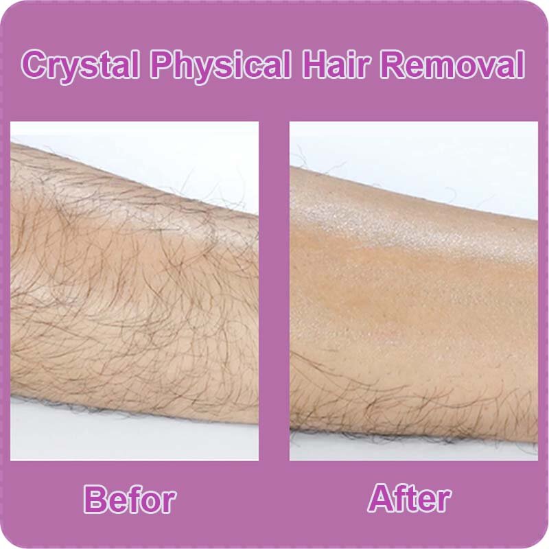 Depilazione indolore Bleame Crystal gomma per capelli riutilizzabile rimozione fisica dei capelli epilatore di sicurezza in vetro depilazione dei capelli