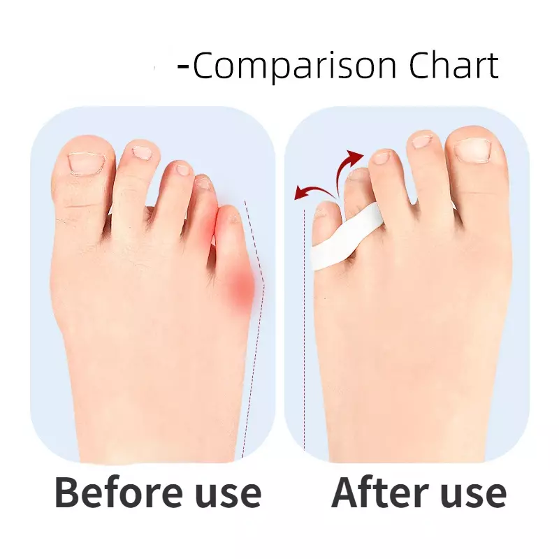 Separatore di separazione valgo per dita piccole Unisex, dispositivo per osso del piede grande femminile, correttore per cuscinetti con manicotto per dita piccole