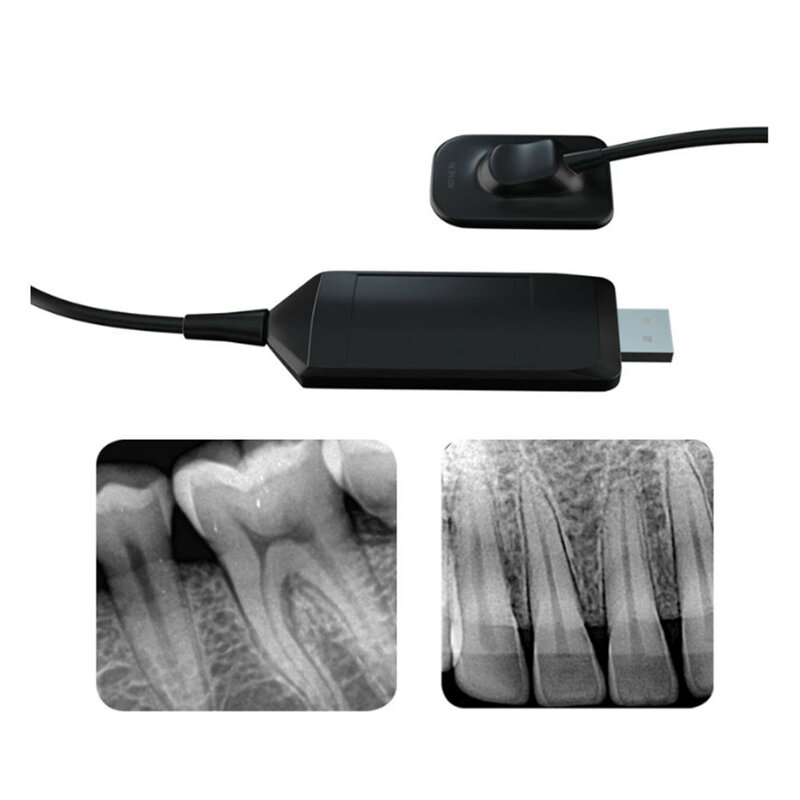 Niższa cena System obrazowania wewnątrzustnego cyfrowy aparat dentystyczny RVG X czujnik promieniowania sprzęt stomatologiczny przenośny cyfrowy aparat rentgenowski rozmiar 2