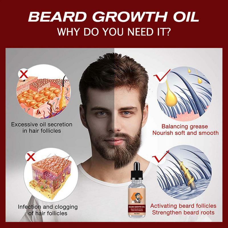 Aceite de barba para hombres, Aceite hidratante para el cuidado de la barba, crecimiento del cabello del bigote, 30ml
