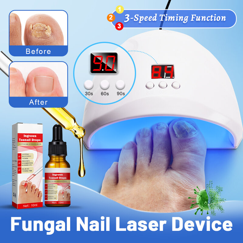 Dispositivo láser para uñas fungicida, reparación rápida de hongos, onicomicosis, uñas de los pies, elimina hongos en las uñas, cuidado de los pies, cura encarnada