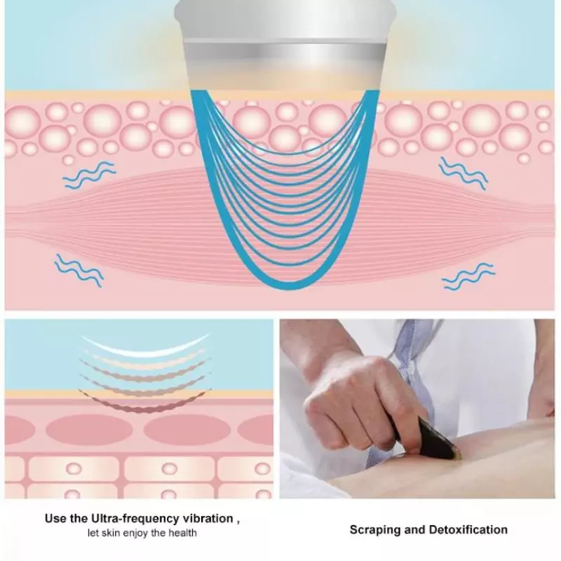 Corpo a vácuo elétrico cupping drenagem cirúrgica massagem terapia de aquecimento saudável gua sha dispositivo para o corpo facial raspagem sucção