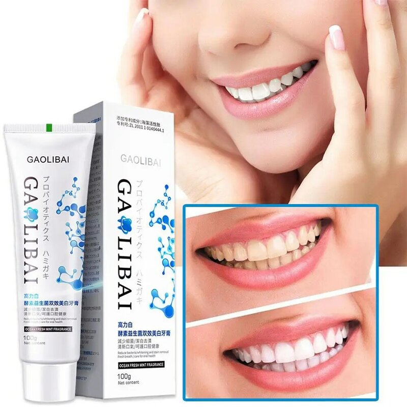Whitening Teeth Toothpaste Dental Calculus Removal Remover Mouth Toothpaste Bad Odour Preventing Fluoride Periodontitis Bre J9P3