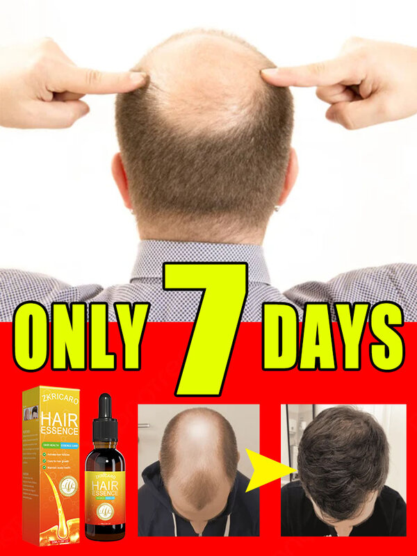 Anti-Alopezie schnelles Haarwuchs öl Ingwer ätherisches Serum