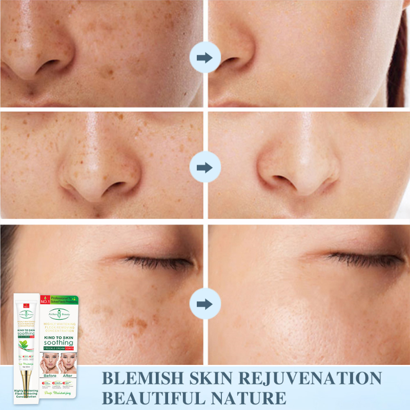 Remove Dark Spots Effective Whitening Freckles Cream Fade Melanin Anti-Pigmentation Improve Dullness Fast Brighten Skin Care