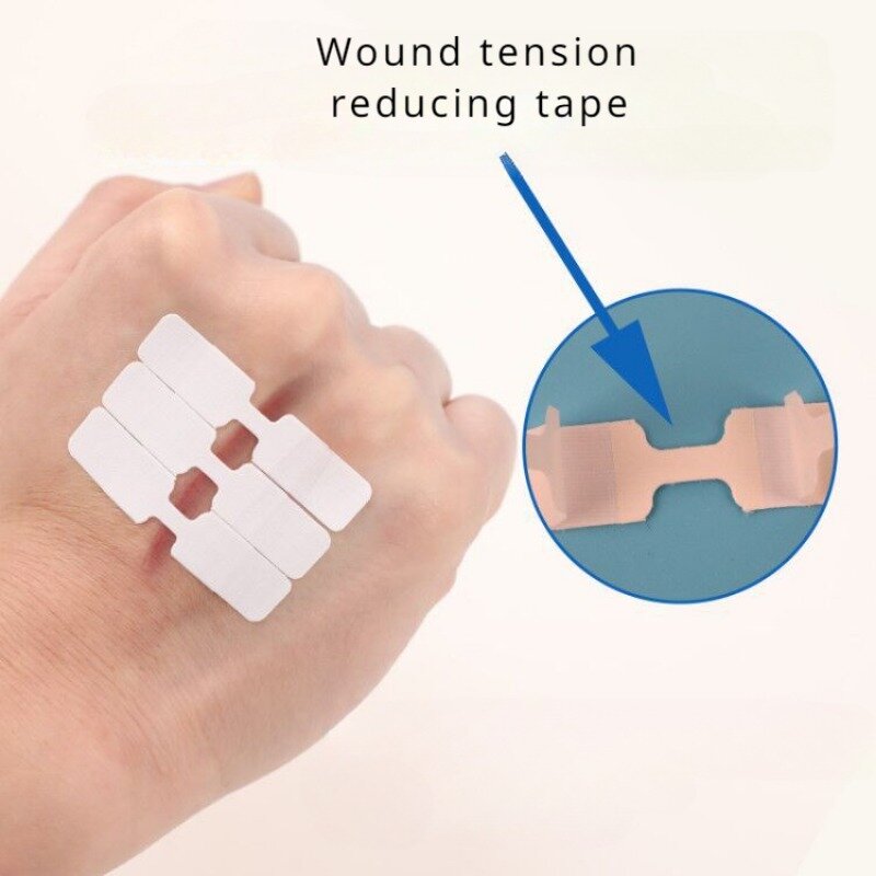 Fita adesiva de redução de tensão Mini emplastros ferida Sutura Band Aid Patch de pele, ligaduras de tensão 4,5x1cm, 20pcs por conjunto