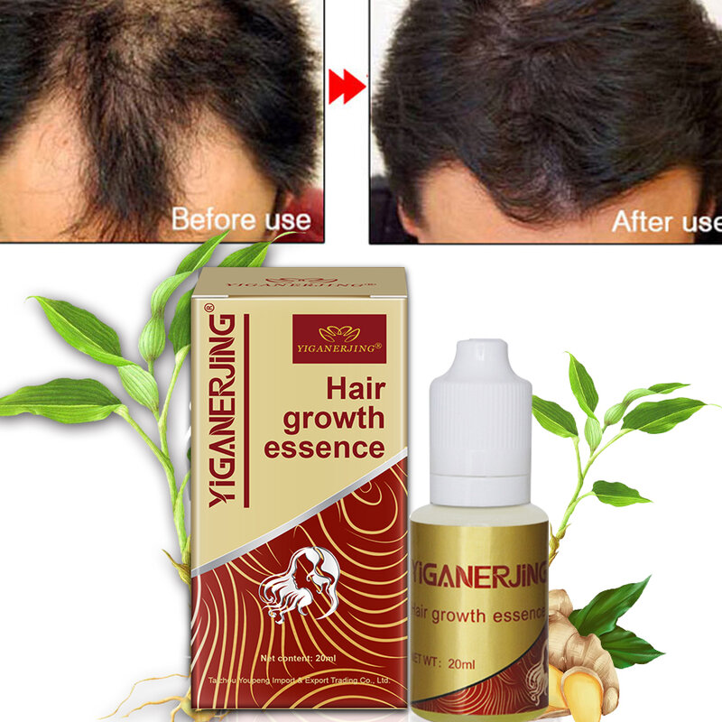 5 buah YIGANERJING minyak esensi penumbuh rambut, cairan penumbuh rambut kecantikan alami, esens Herbal China, perawatan kulit kepala 20ML