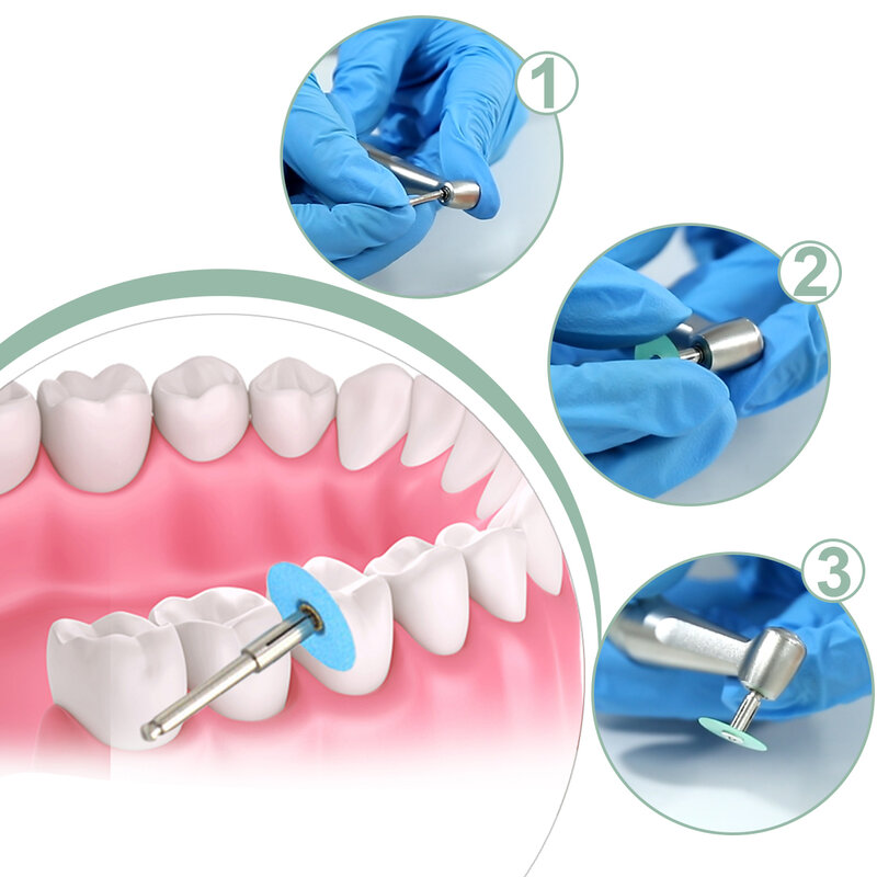 Discos de pulido Dental de reducción gruesa, juego de rayas de mandril contorneado, materiales de blanqueamiento Dental, disco de 4 colores