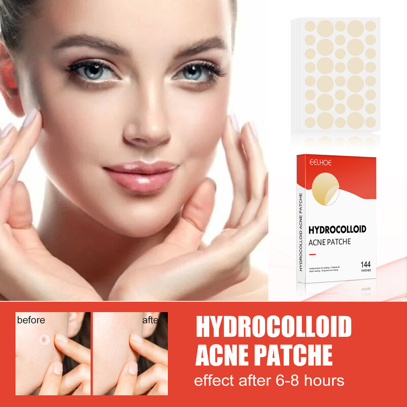 Parche de granos de acné hidrocoloide para cubrir manchas, pegatinas para cara y piel