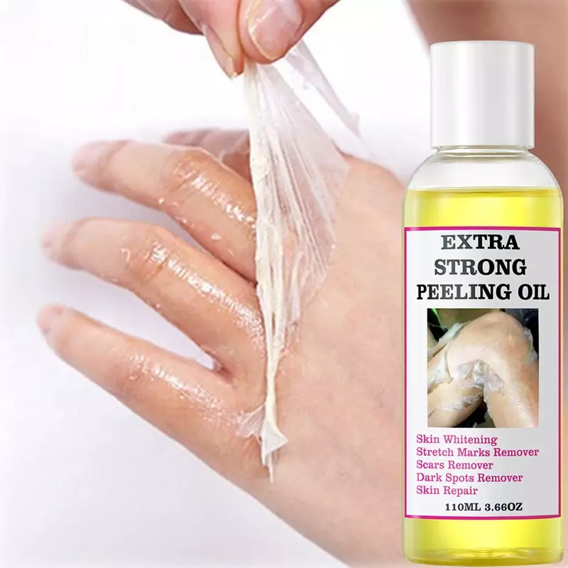 110ml olio Peeling giallo Extra forte sbiancante olio Peeling schiarire gomiti ginocchia mani melanina anche tono della pelle e sbiancare la pelle