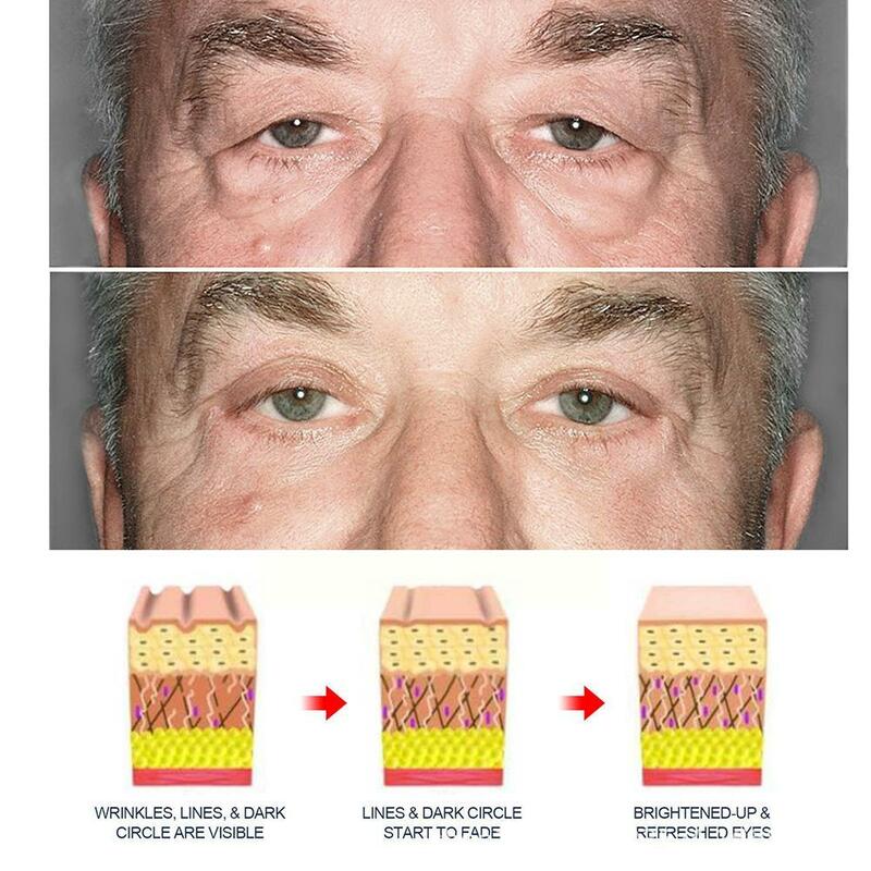 男性のためのアイクリーム,保湿,目の下のシミを治療するためのデバイス,目の下のシミを刺激する