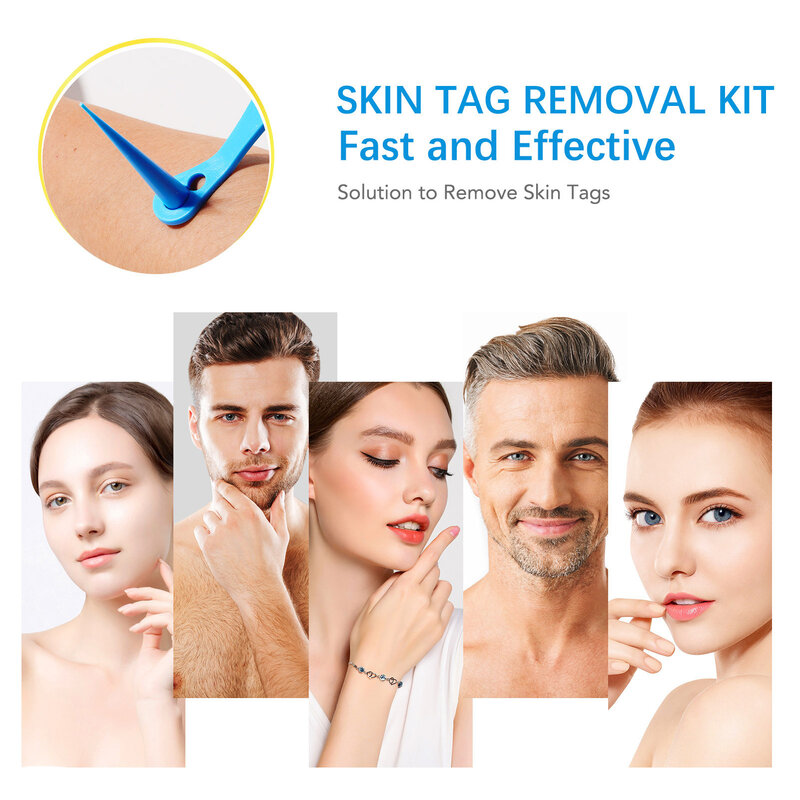 Haut Tags Entfernung Kit 2 IN 1 Haut Tags Entferner Bands Kit ReliableTo Große Haut Tags Reparatur Hautpflege Produkte Für 2-8mm