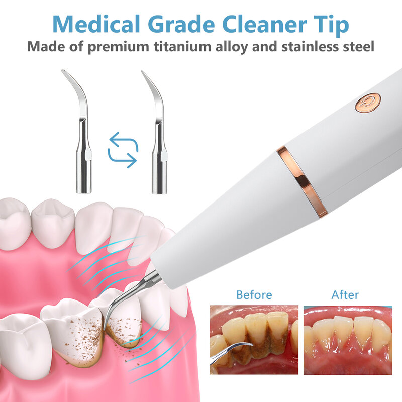 Ultraschall elektrische Zahn reiniger Zahn zähne Scaler Zahnbelag Zahnstein Fleck Zahnstein entferner Zahn aufhellung werkzeug