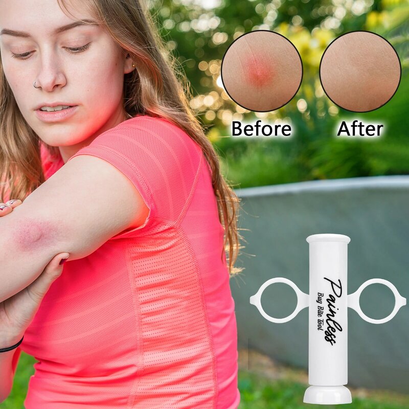 Natural Detoxifier Outdoor First Aid Safety Tool Bed Bug Bee Wasp Insect Sting Sucker To Relieve Pain Safety Emergency Tool
