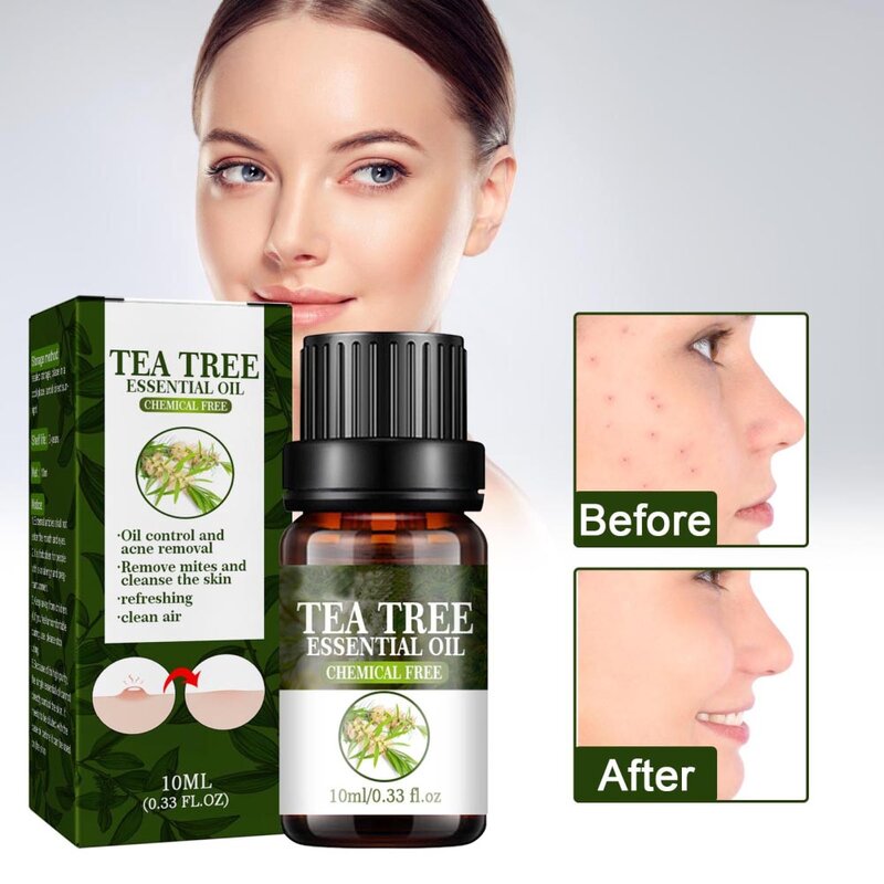 10ML di olio essenziale dell'albero del tè rimuovi i pori idratante olio-controllo siero viso olio essenziale per aromaterapia diffusore cura della pelle