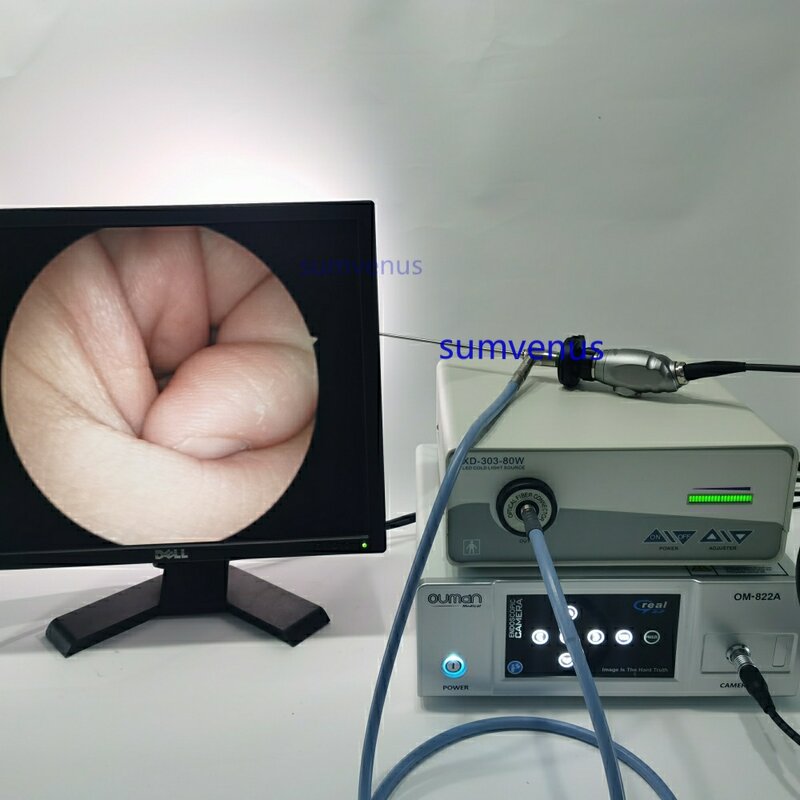 HD 2.7mm 4mm 0 30 45 70 90 graus Médico Cirúrgico Rígido Endoscópio Sinusoscópio ENT Endoscopia Câmera
