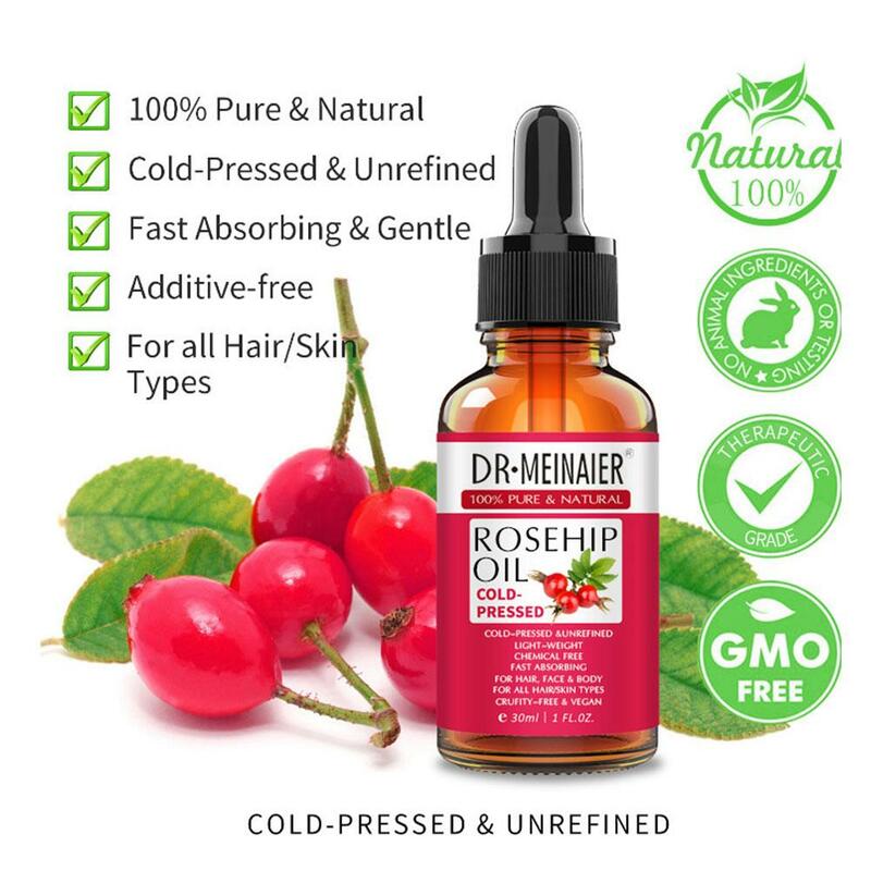Rosehip-aceite esencial puro Natural para el cuidado de la piel, suero antienvejecimiento, antiarrugas, hidratante, Perfumes, masaje, 30ml, L5e5