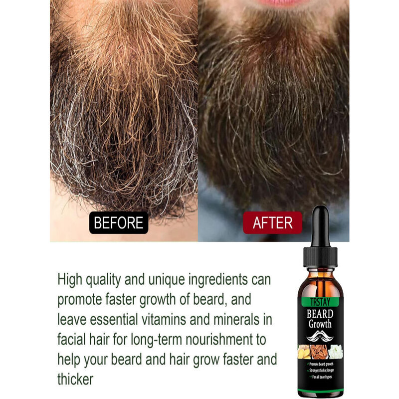 Aceite esencial para el crecimiento del cabello para hombres, producto antipérdida de cabello, aceite Natural para el crecimiento del bigote, rodillo nutritivo para el cuidado de la barba