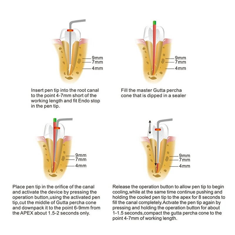Azdent Dental Cordless Endodontic Root Obturation System, Endo Pen aquecida, 2 Dicas, 3 segundos de aquecimento rápido, Endodontic Root Tools