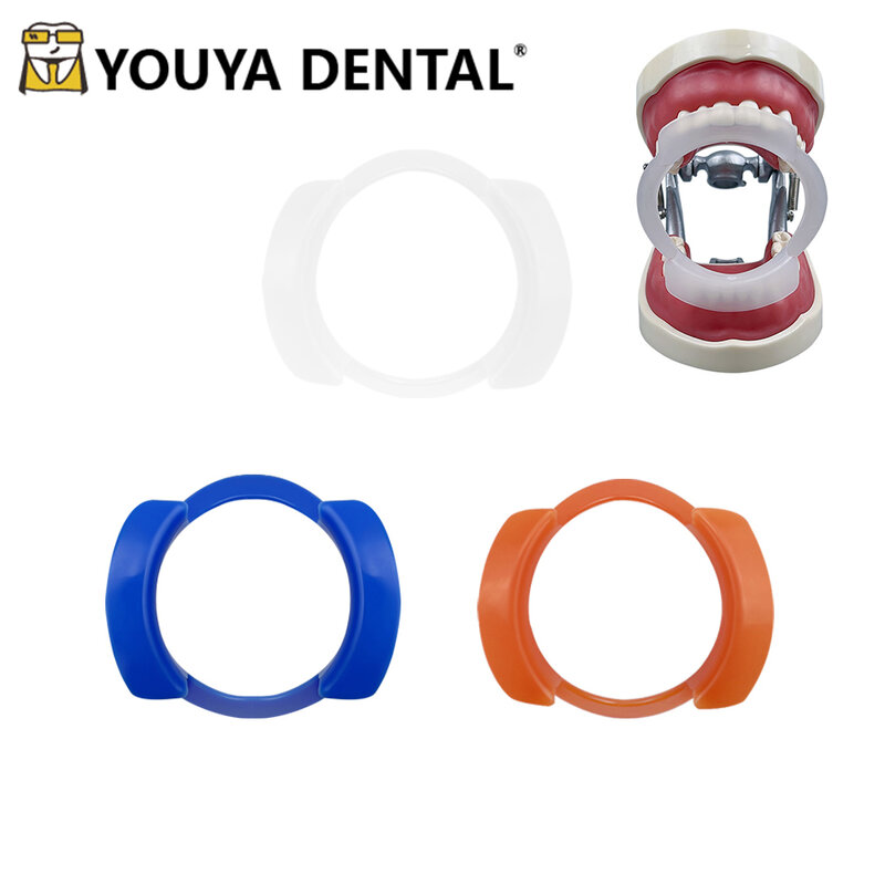Abridor de boca dental plástico em forma de O, Retratores bochecha intraoral e ortodôntica, Higiene Oral, Clareamento dental