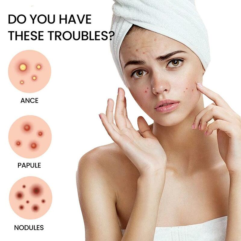 Parches de acné hidrocoloide de colores para el cuidado de la piel, bonitos parches de espinillas de acné en forma de estrella para la cara, pegatinas invisibles de cobertura Zit, 200 recuentos