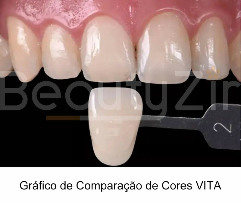 كتلة زركونيا متعددة الطبقات للأسنان ، سوبر الشفافية ST و ML ، 95 ، من من من من من من