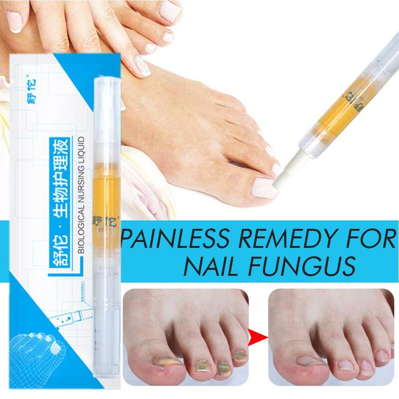 Nail Fungus Treatment Essence Serum, Reparação de mãos e pés, Gel de remoção, Gel anti-infeccioso, A4Z8, 3ml