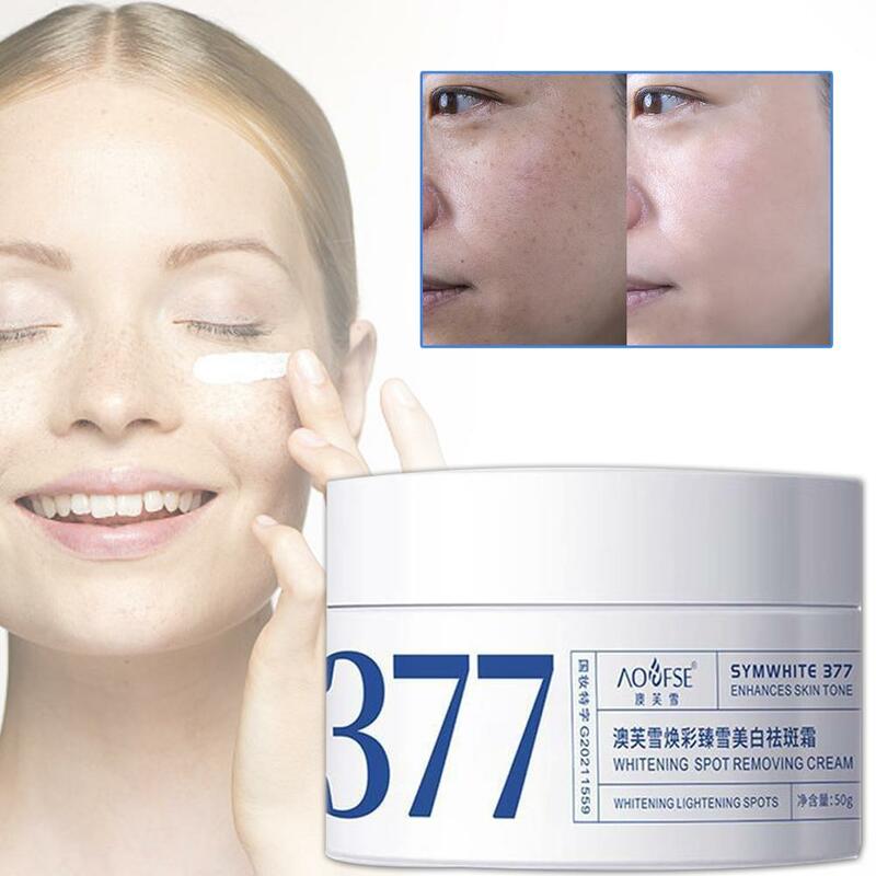 Creme eficaz para clareamento e remoção de sardas, desvanece manchas, ilumina a pele, pele hidratante, cuidados faciais, 377