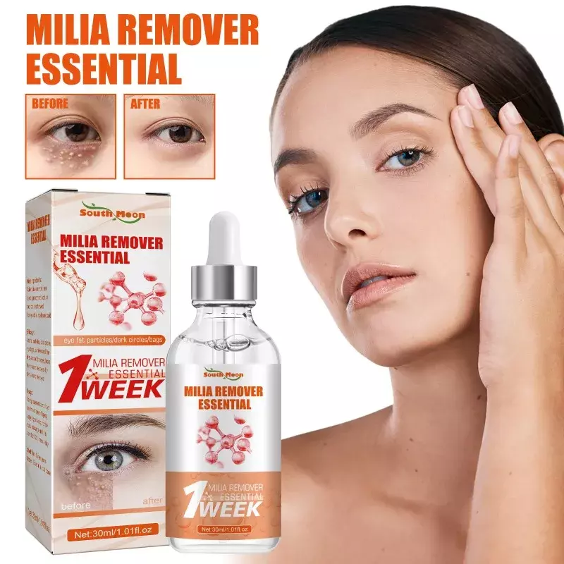 Milia Remover Essential Eye Serum Effective Removes Fat Granules eye Bags Anti-Particles Puffiness Improve Dark Cicle 30ml