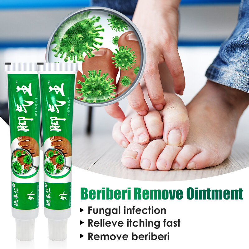 Bériberi-Crème anti-démangeaison pour les pieds, produit à base de plantes, élimine le maïs, pour les athlètes, 2 pièces, A1066