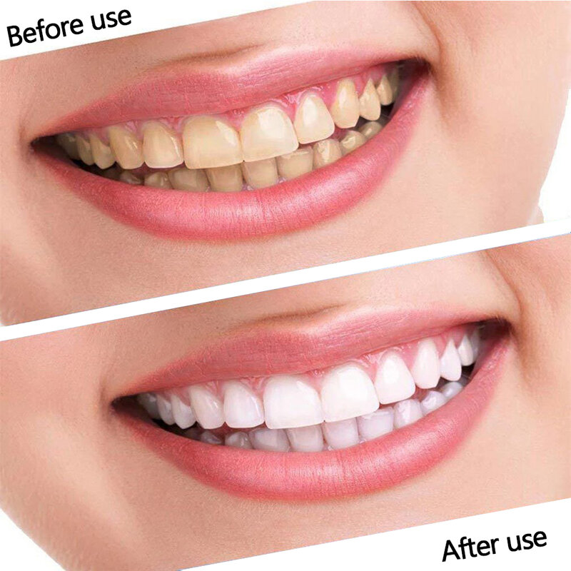 FlowWeek paski wybielające zęby licówki dentystyczne wybielające żelowe paski biały zestaw zębów jasne-paski 28 szt.