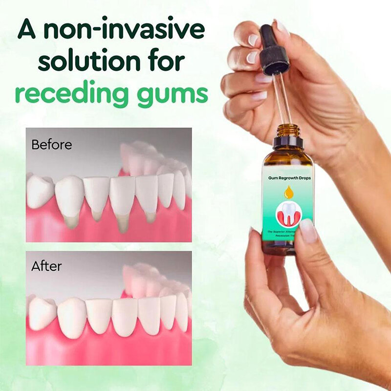 Gum Repair Drops Relieve Receding Gingival Swelling Gum Cleaning Care Oral Periodontal Hygiene Remove Stain Remove Yellow Serum