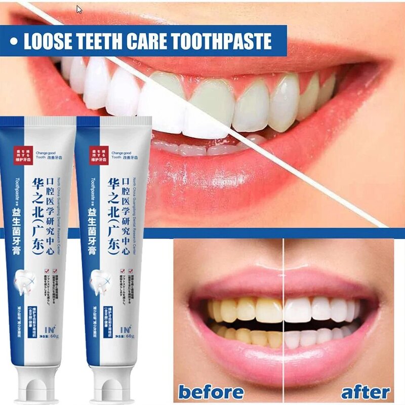 Pasta gigi pemutih gigi, perbaikan cepat dari berlubang penghilang noda plak memutihkan memperbaiki gigi