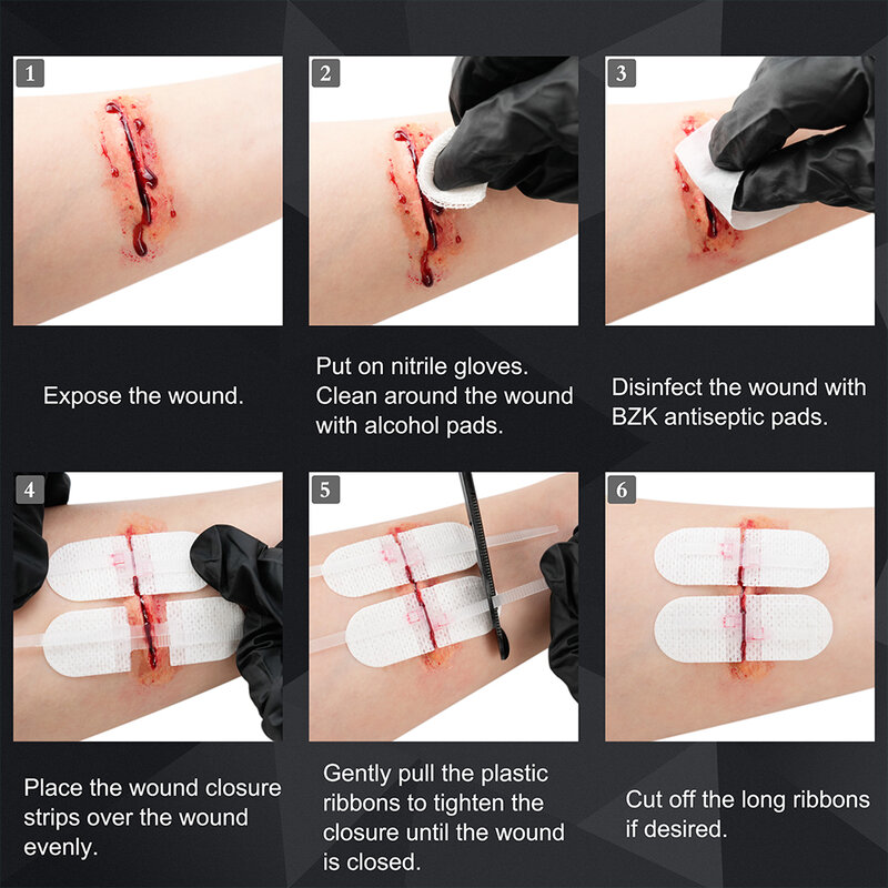 RHINO RESCUE Zip Stitch 6 buah dengan gaun luka, Strip penutup luka, Zipstitch Laceration penutupan Kit untuk memotong Perawatan Band-aid