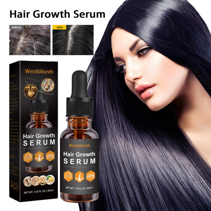 Aceite para el crecimiento del cabello para hombres y mujeres, suero para el tratamiento del cuero cabelludo anticaída, jengibre, 7 días, productos para el crecimiento rápido del cabello