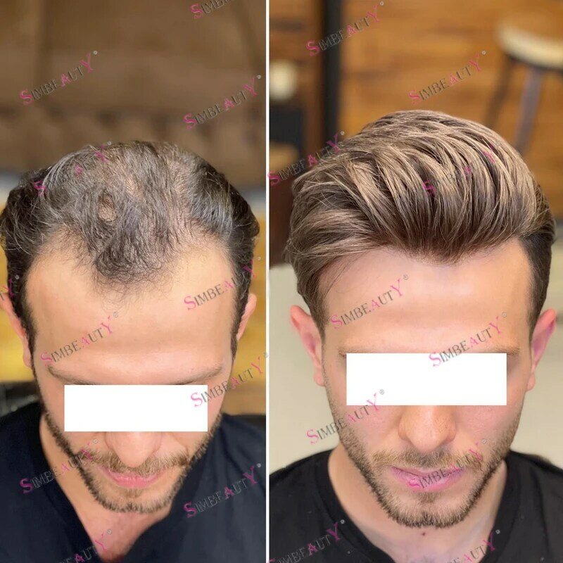 100% rambut manusia hitam pria Wig Miscroskin Kulit Ultra tipis dasar Vlooped 120 kepadatan garis rambut alami Sistem rambut palsu pria
