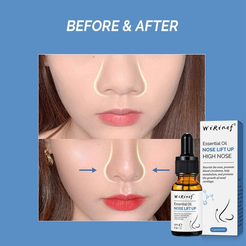 Aceite Esencial para Realce de nariz, cuidado Nasal puro más pequeño, remodelación Natural, rinoplastia fina, hueso, T3E7