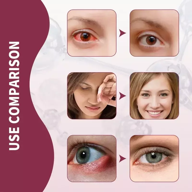الجمال الطبيعي العين تخفيف المصل ، وتخفيف التعب ، احمرار وتورم التهاب الجفن ، جوهر الرعاية الصحية