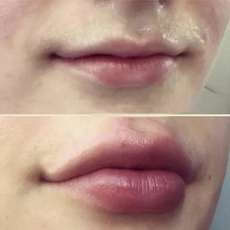 오래 지속되는 통통한 입술 오일, 비 입술 주입, 입술 강화 세럼, 섹시 모이스처라이징 샤이니 립 투명 리퀴드 오일, 5ml, 3 개
