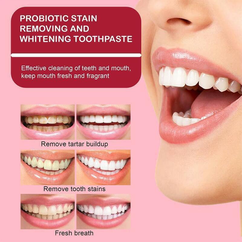 Dentifricio sbiancante probiotico rimuovi macchie di placca denti gialli alito fresco protegge le gengive strumenti di riparazione sbiancante dentale 120g