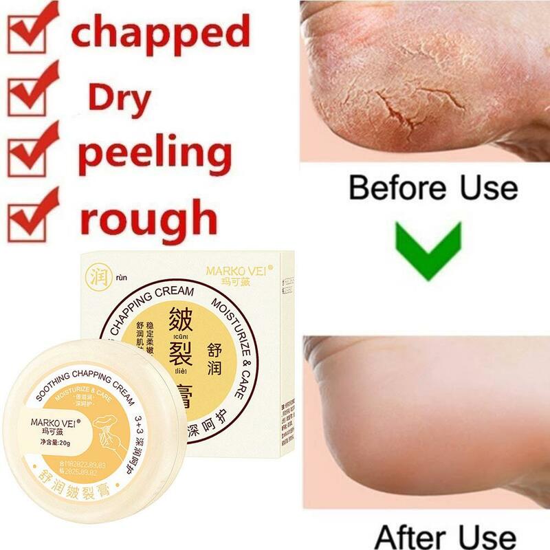 20g Anti-Drying Crack Foot Cream Heel Cracked Repair Mask Care Cream Cream Dead Skin Foot Removal Hand Q3I7