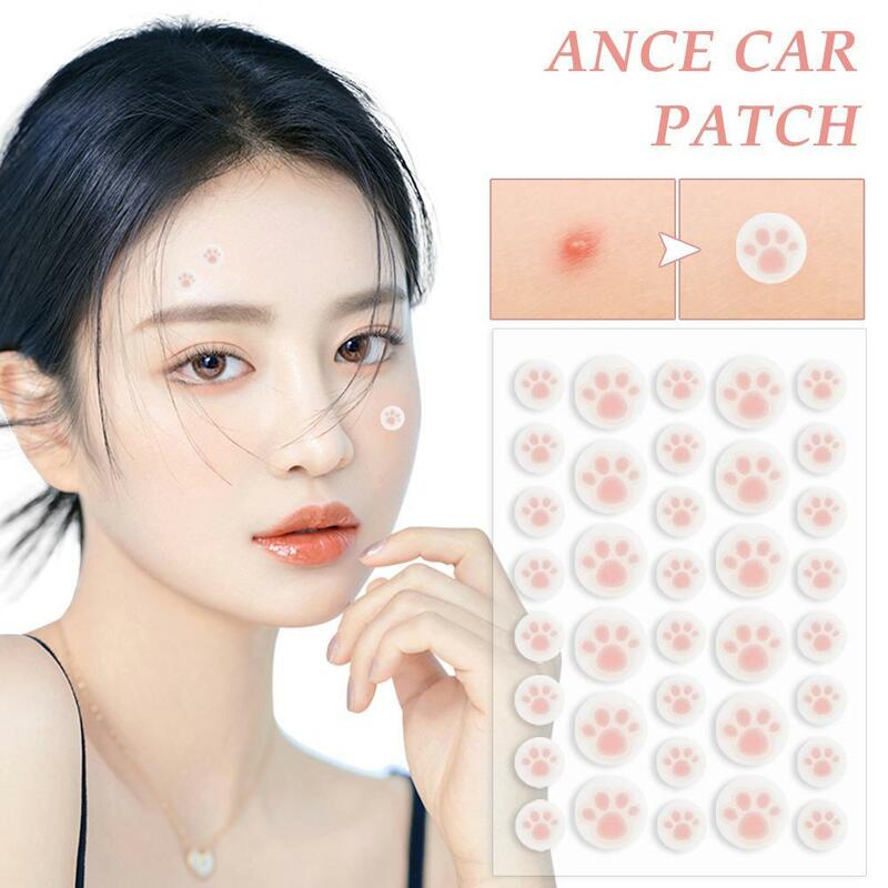 Cat Claws Acne Removal Pimple Patch Removal Skin Care Stickers Originality Concealer Face Spot Beauty Makeup Tool Ance Care