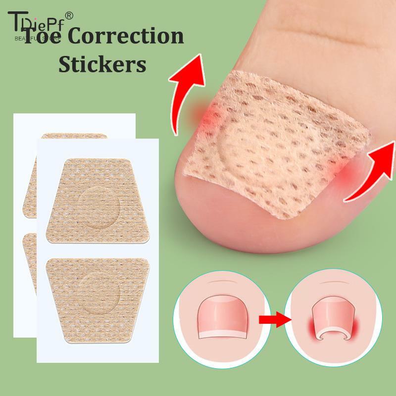 2/6/12Pc Ingrown Toenail Toe Correction Stickers Nail Art Foot Patches Feet Care Paronychia Treatment Recover Pedicure Foot Tool