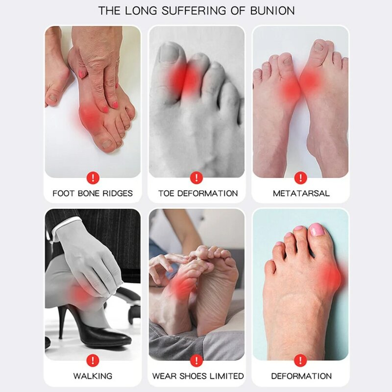1PC korektor na duży palec u nogi regulowane skarpetki ortopedyczne Separator palców u nóg ulga w bólu palucha koślawego ochraniacz stóp narzędzia do pielęgnacji stóp