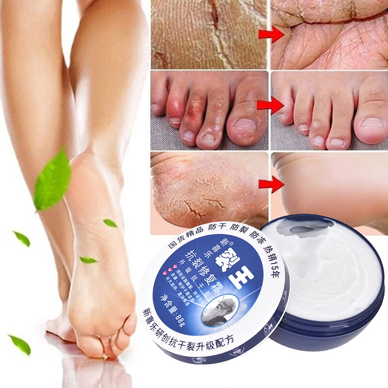 Crème Anti-sec pour les pieds et les mains, 1 pièce, Peeling du talon, réparation, hydratation, élimination de la peau morte, soins des pieds, masque